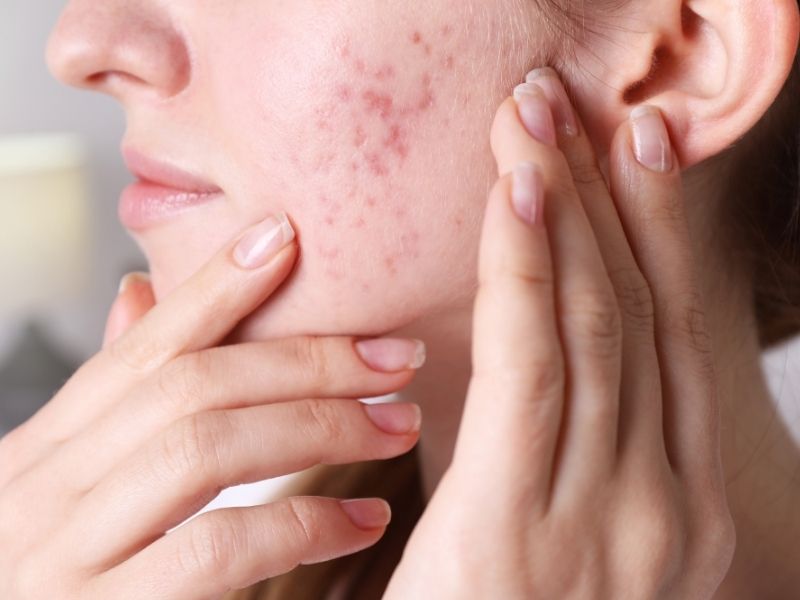 Anti-allergic soothing